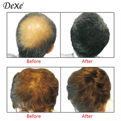 Dexe Hair Building Fibers Black – Instant Hair Thickening Solution