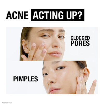 Neutrogena Deep Clean Acne Foaming Cleanser – 40g | Salicylic Acid Face Wash for Acne-Prone Skin