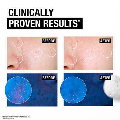 Neutrogena Deep Clean Acne Foaming Cleanser – 40g | Salicylic Acid Face Wash for Acne-Prone Skin