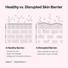 The Ordinary Soothing & Barrier Support Serum - Restore Skin Health
