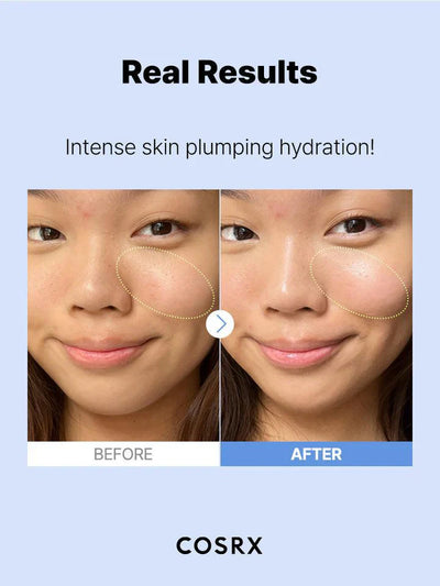 COSRX The Hyaluronic Acid 3 Serum – Intense Hydration & Plump Skin