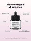 COSRX The Niacinamide 15 Serum – Powerful Oil Control &amp; Skin Brightening
