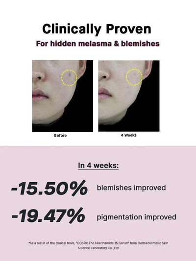 COSRX The Niacinamide 15 Serum – Powerful Oil Control &amp; Skin Brightening